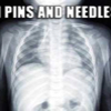 062207_needles1